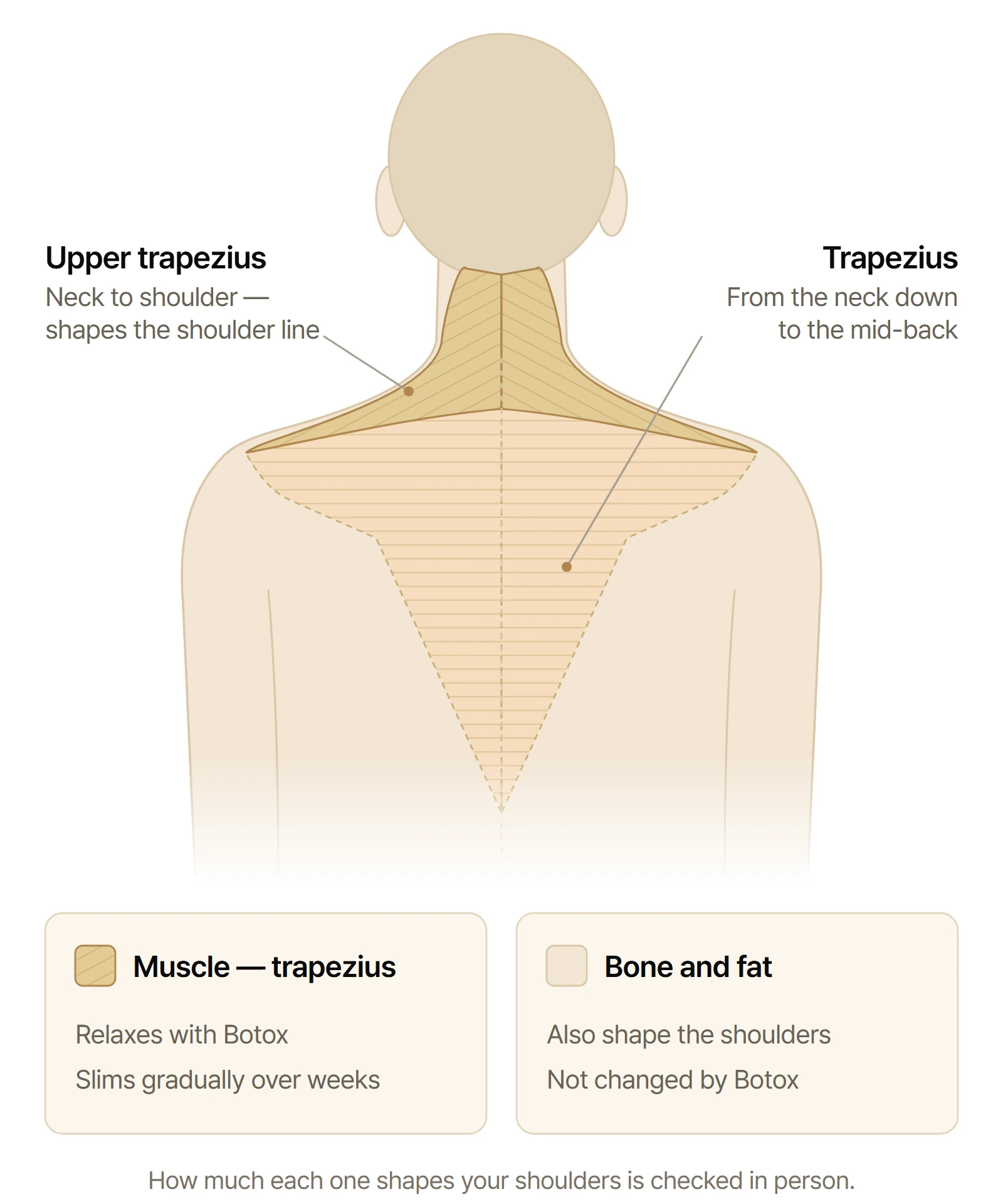 Back view of the neck and shoulders: the trapezius runs from the base of the skull and neck to each shoulder and down to the mid-back; its upper part, from the neck to the shoulder, shapes the shoulder line.